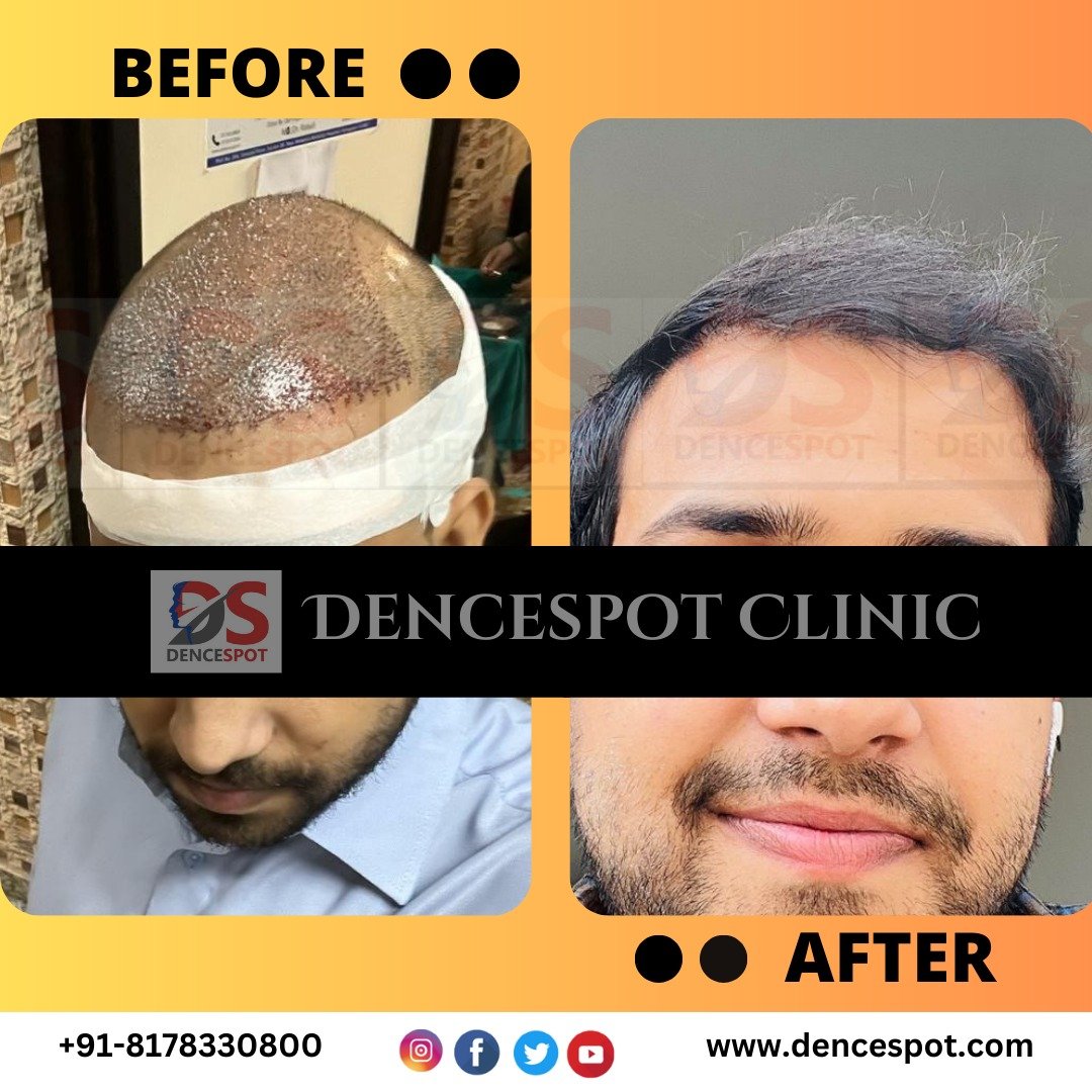 DenceSpot Patient Result Transformation
